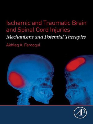 cover image of Ischemic and Traumatic Brain and Spinal Cord Injuries